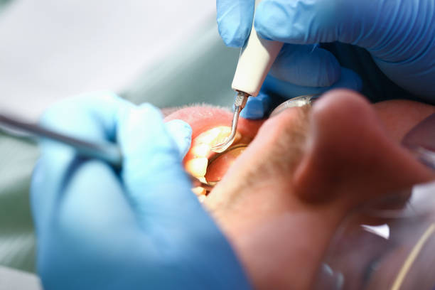 Best Pediatric Emergency Dentist in Appalachia, VA